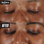 Kiehl's Clearly Corrective Dark Spot Serum, Paraben-free, Mineral Oil-free - Image 4